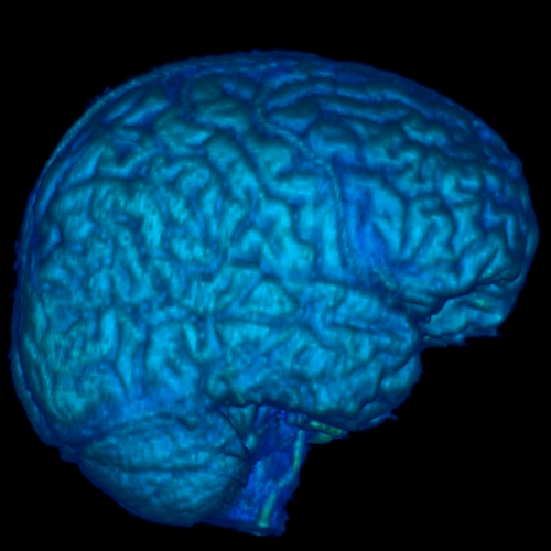 Lateral Right View of Neural Tissue