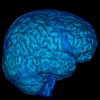 Brain Reconstruction