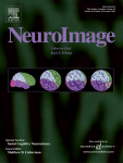 NeuroImage Volume 28, Number 4 Cover