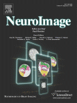NeuroImage Volume 45, Issue 1, Supplement 1 Cover