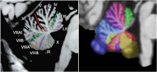 Cerebellum Colored by Anatomical 
Region